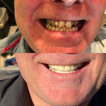 Slider image (7) Easy Dental